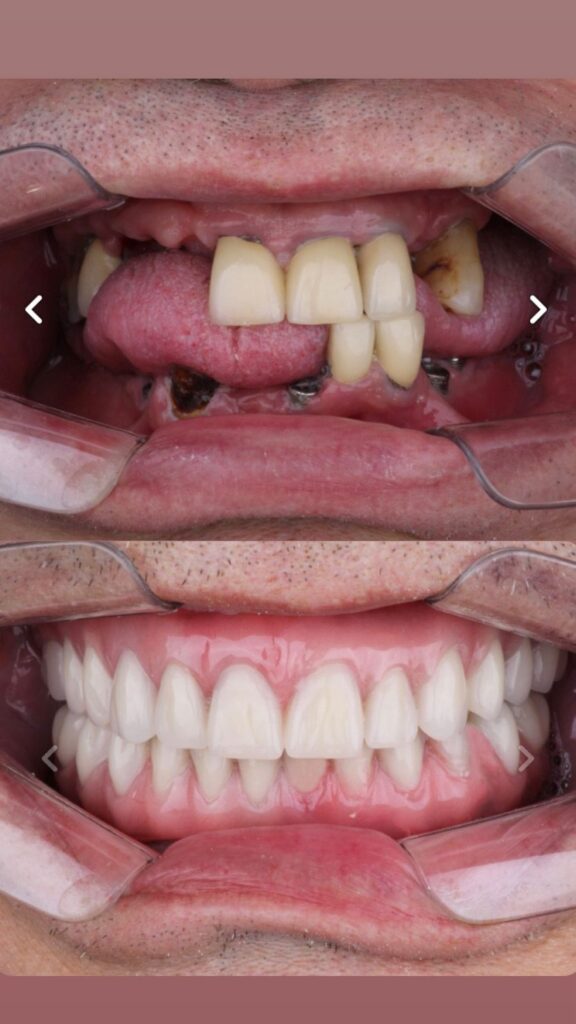 La Belle Implantes dentários